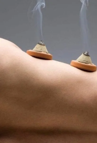 Moxibustion cones providing controlled warmth